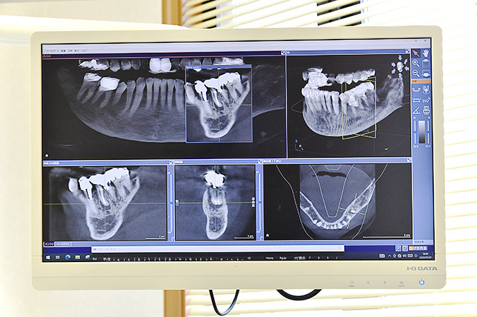 CBCT2